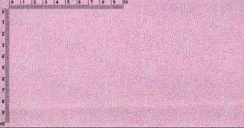 txpk100000